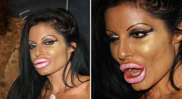 Plastic-Surgery-Gone-Wrong-Featured.png